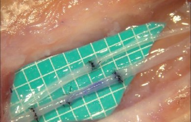 Микрососудистые анастомозы - WETLAB Образовательный центр WETLAB | Микрососудистые анастомозы - WETLAB