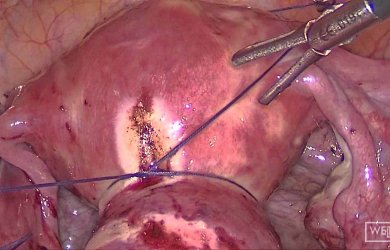 Азы лапароскопии в гинекологии Образовательный центр WETLAB | Азы лапароскопии в гинекологии