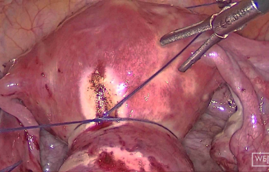 Образовательный центр WETLAB | Азы лапароскопии в гинекологии