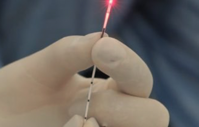 Modern methods of treatment of varicose veins. Образовательный центр WETLAB | Modern methods of treatment of varicose veins.
