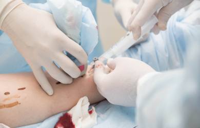 Modern methods of treatment of varicose veins. Образовательный центр WETLAB | Modern methods of treatment of varicose veins.
