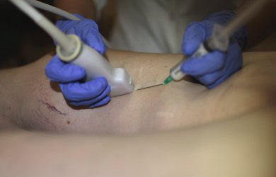 Modern methods of treatment of varicose veins. Образовательный центр WETLAB | Modern methods of treatment of varicose veins.