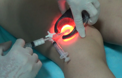 Modern methods of treatment of varicose veins. Образовательный центр WETLAB | Modern methods of treatment of varicose veins.
