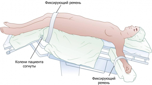 Положение Тренделенбурга