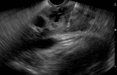 Endosonographic image using a convection sensor Образовательный центр WETLAB | Endosonographic image using a convection sensor