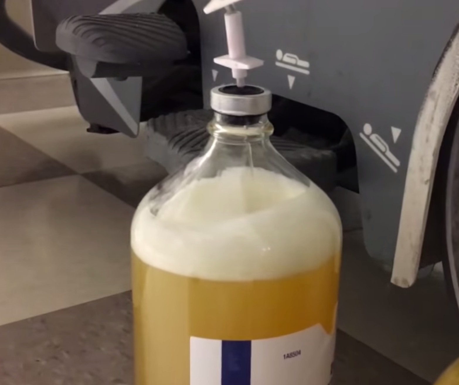 Лапароцентез. Техника операции. - WETLAB