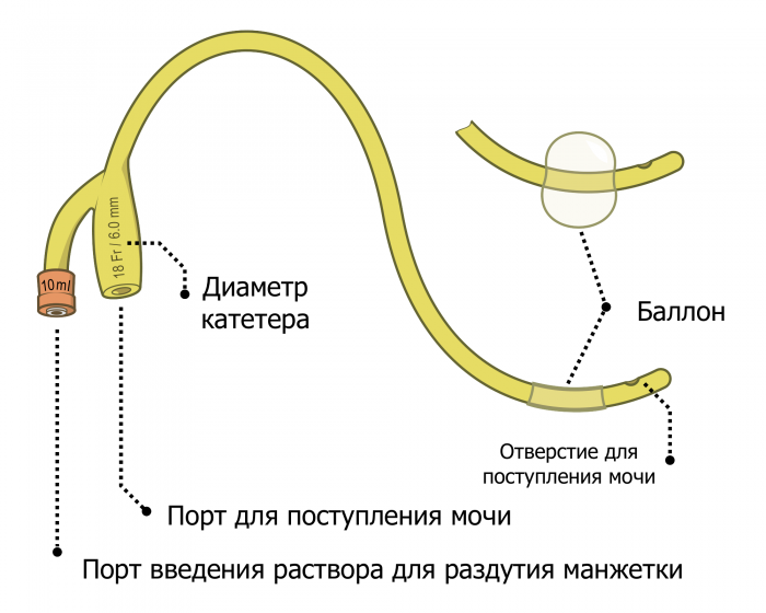 Как поставить мочевой катетер